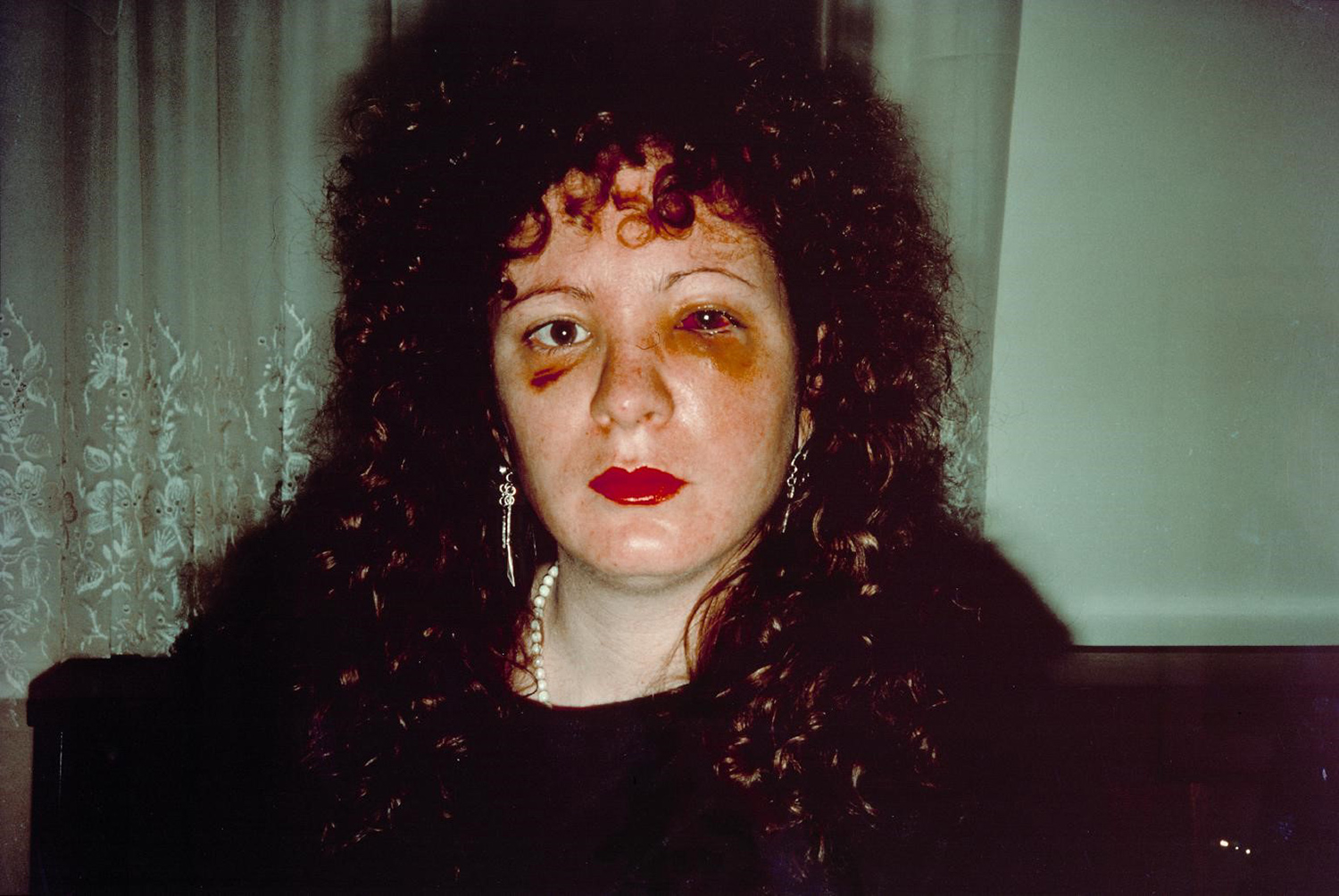 Nan One Month After Being Battered, Nan Goldin (1984)
